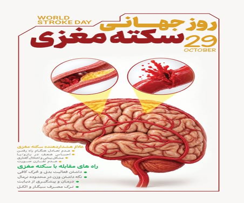 29 اکتبر روز جهانی سکته مغزی گرامی باد.